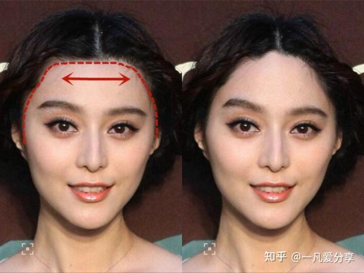 美人尖花瓣发际线锯齿发际线那种发际线适合你的脸型