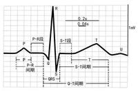 心电图t波图片大全图片