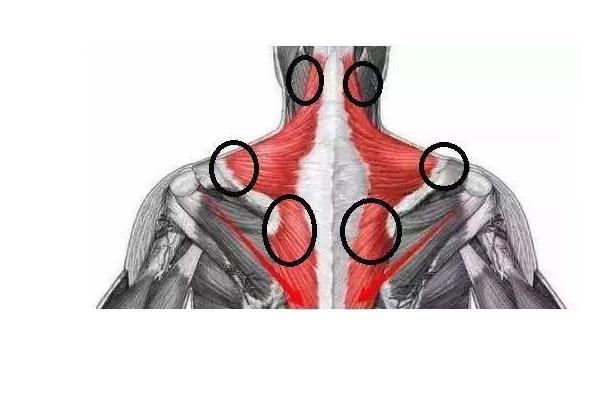 斜方肌肌肉酸痛怎么办