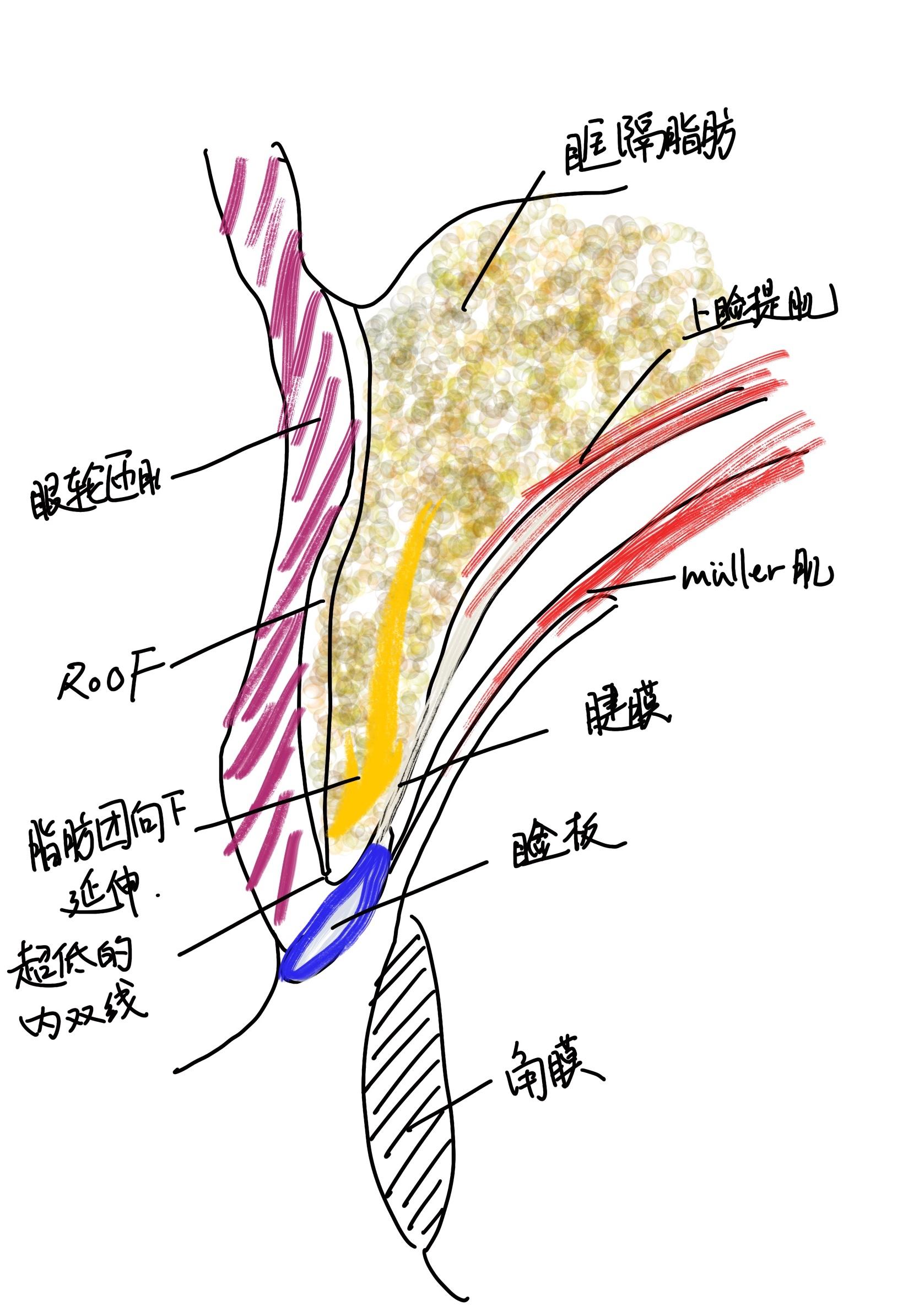 身上长了小肉瘤，竟是因为感染 HPV？|丁香医生