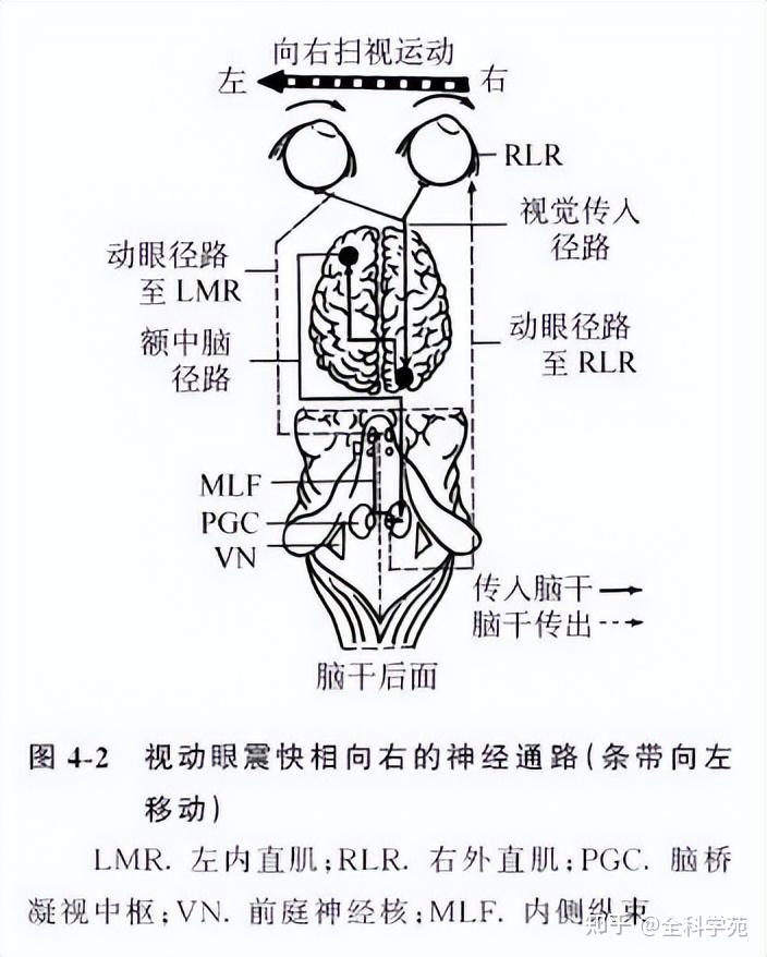 前庭眼反射障碍即出现眼球震颤简称眼震