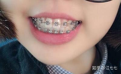 v2-e3ef894fdb322475de7423aebc42b8a4_b.jpg