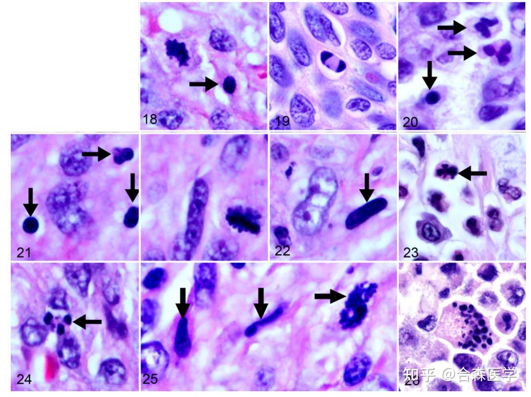 核分裂象的评估，看这一篇就够了！ - 知乎