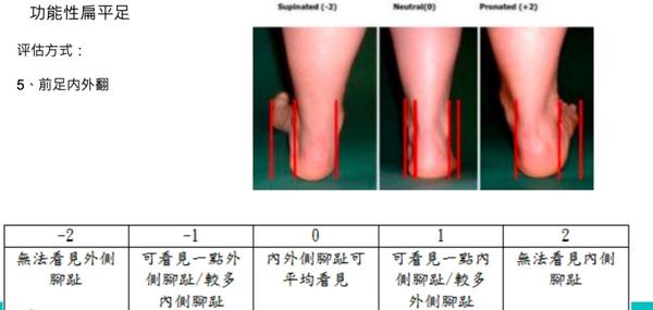 一般治疗师不会告诉你的有关扁平足那些事儿 知乎