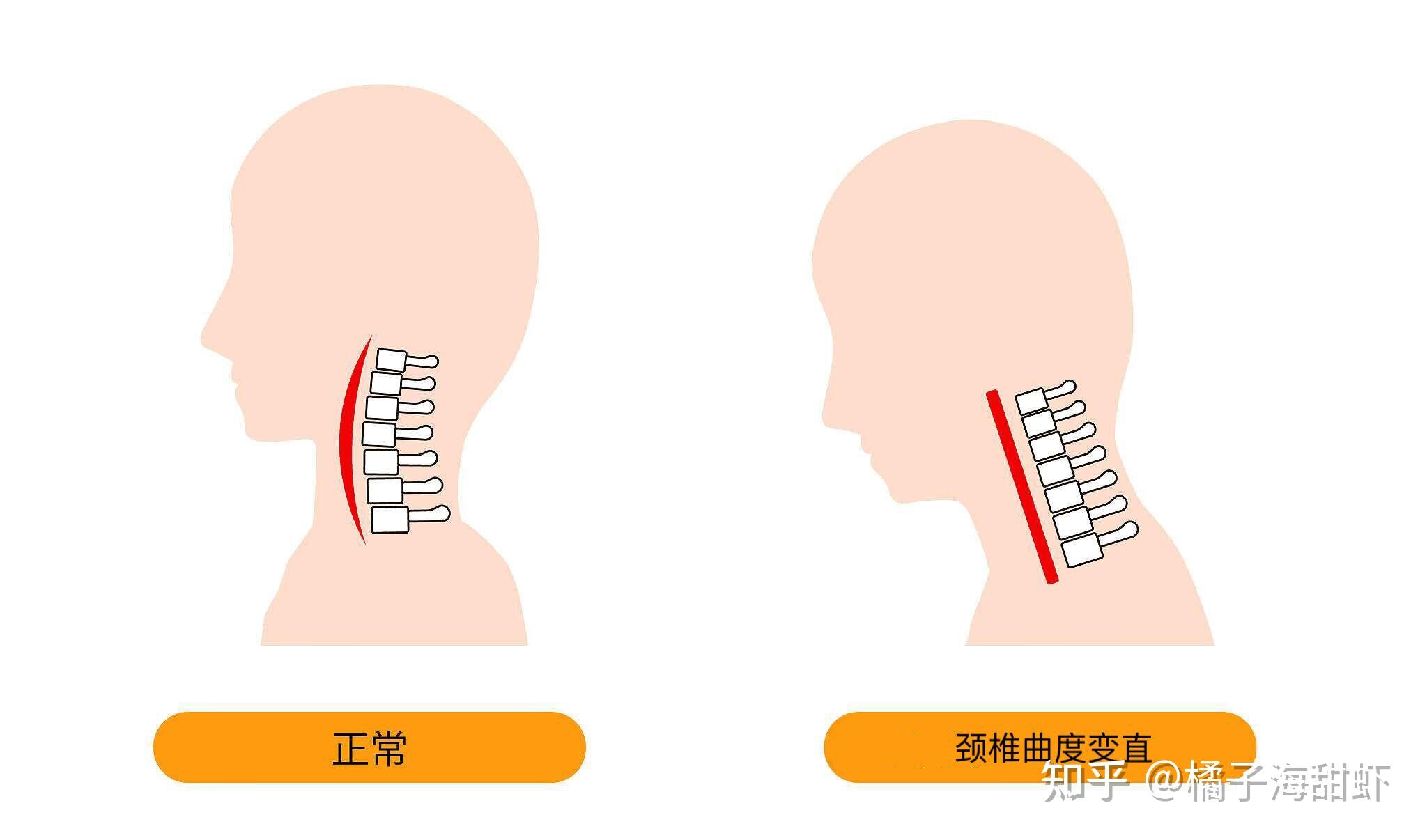 八款热门颈椎按摩仪真实测评——2023年哪款颈部按摩仪好?