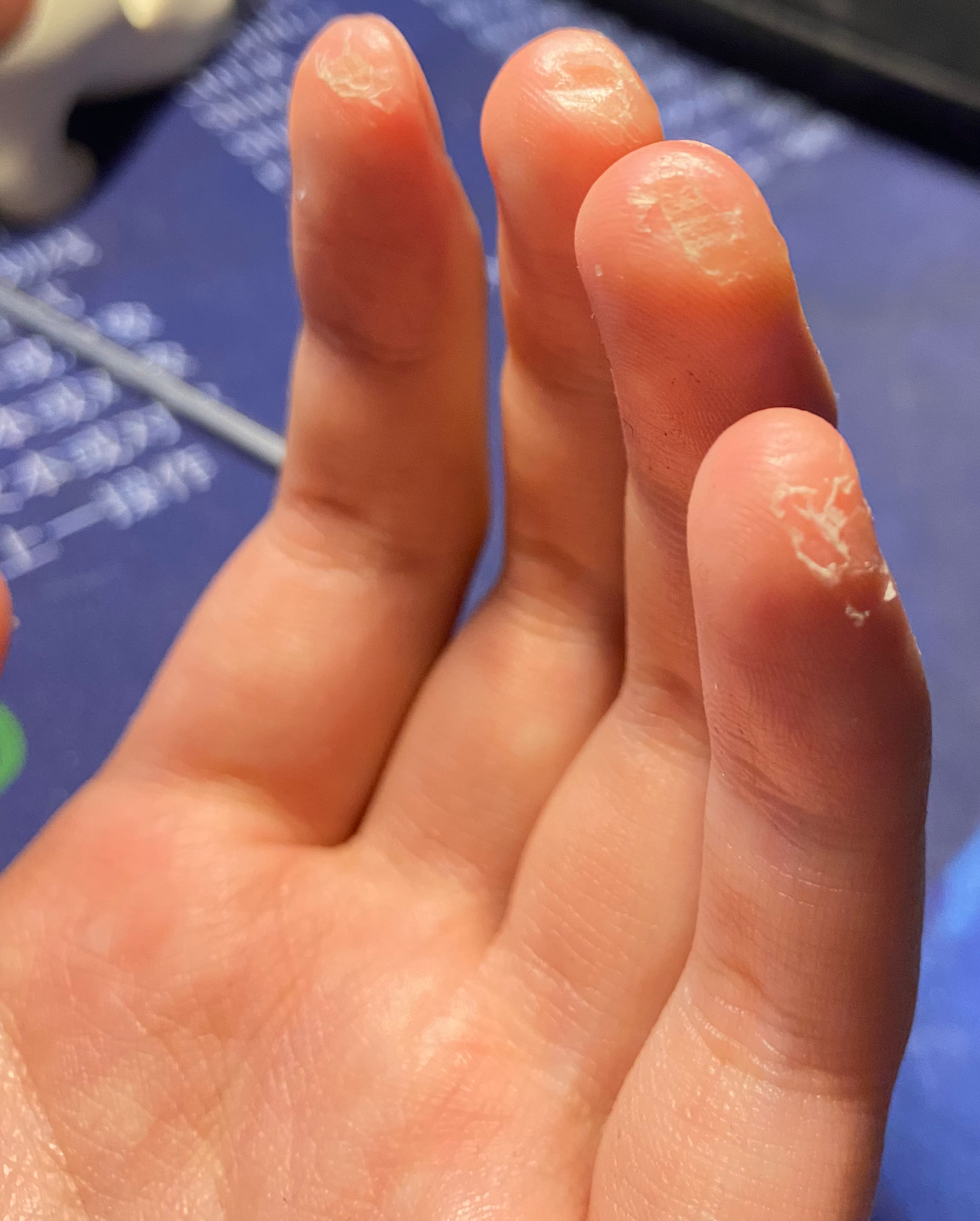 学吉他左手多久可以起茧? - 知乎