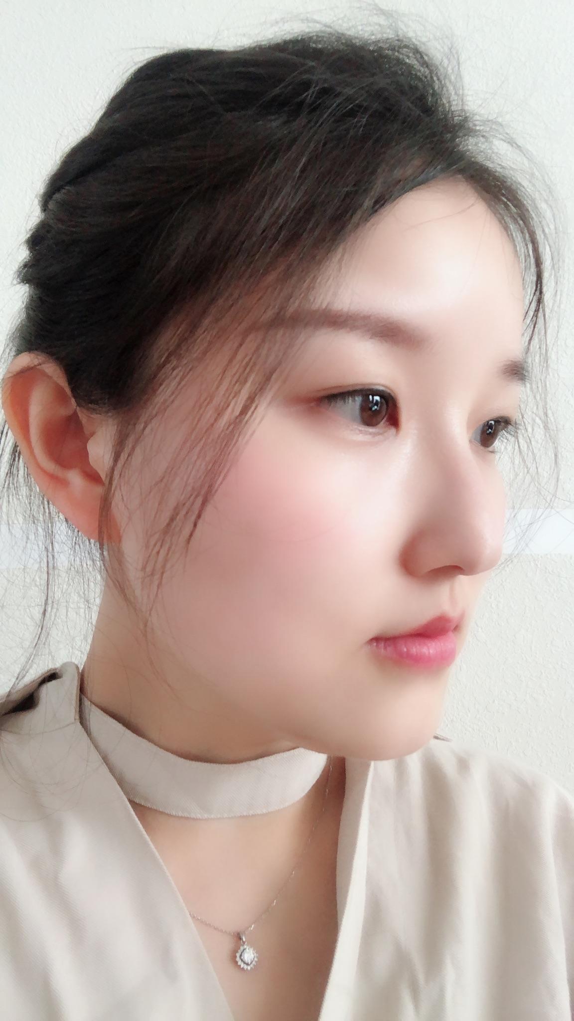 鼻子太挺拔有什么体验?