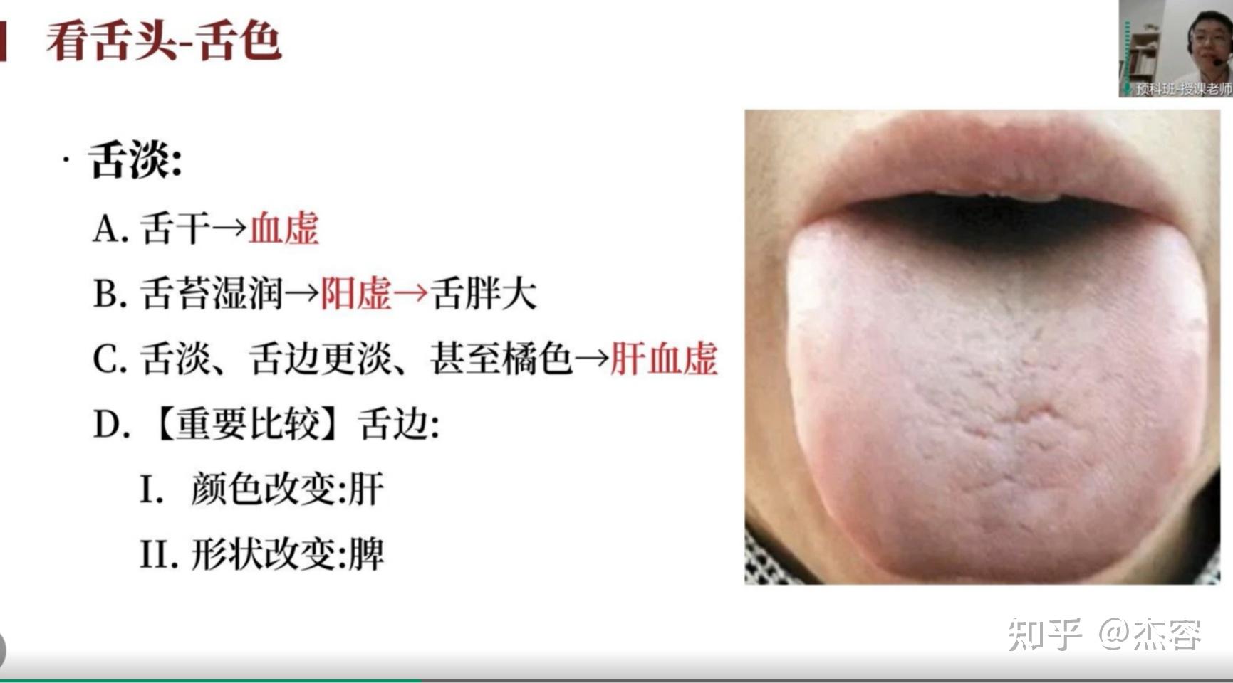 中医学习笔记5:舌诊 - 知乎