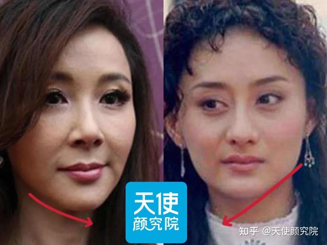 嘴角下垂的女人面相图片