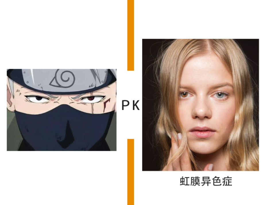 男神也有虹膜异位症,例如文特沃斯·米勒,本尼迪克特·康伯巴奇(卷福)