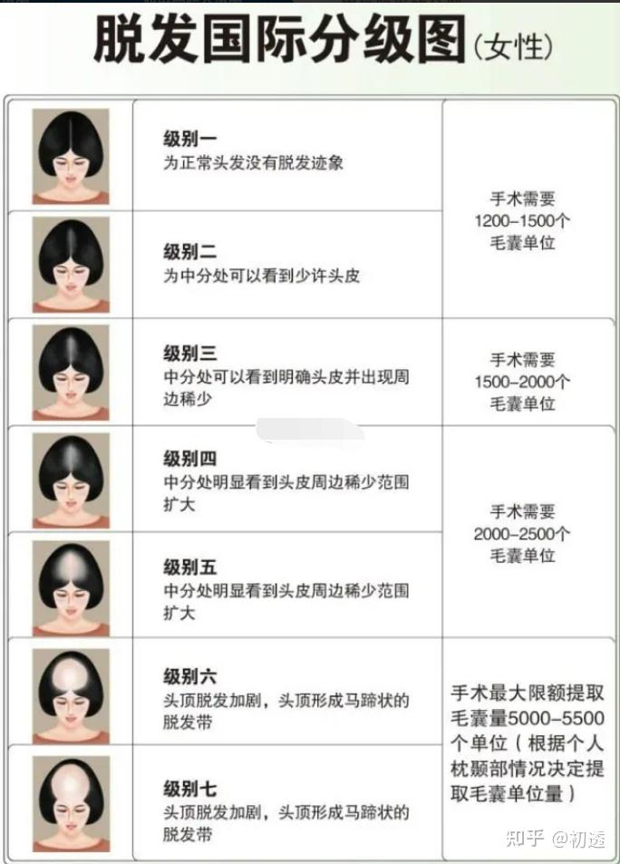 植发最全攻略||到底靠谱吗?价格多少钱?真的很贵吗?植发技术有哪些? - 知乎