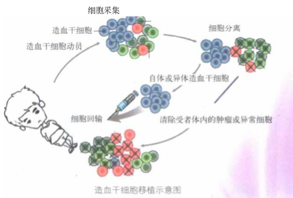 造血干细胞移植和系统如何重建?