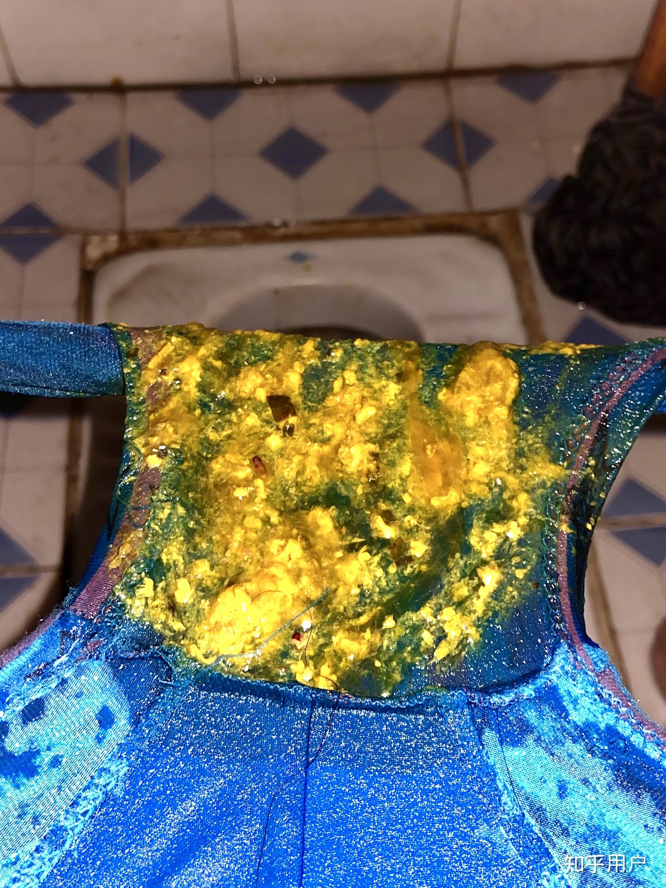 拉肚子能否靠强烈的意志去控制住