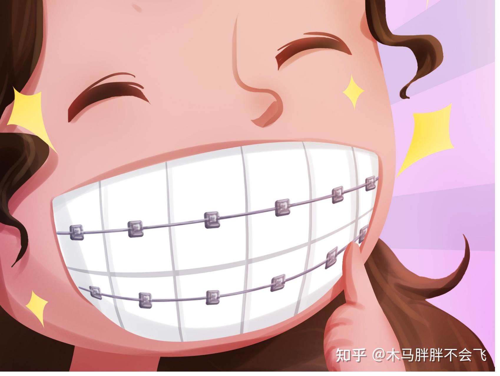 还是我们金属牙套,影视剧里,也是大多以满嘴的钢牙来佐证"牙套妹"的