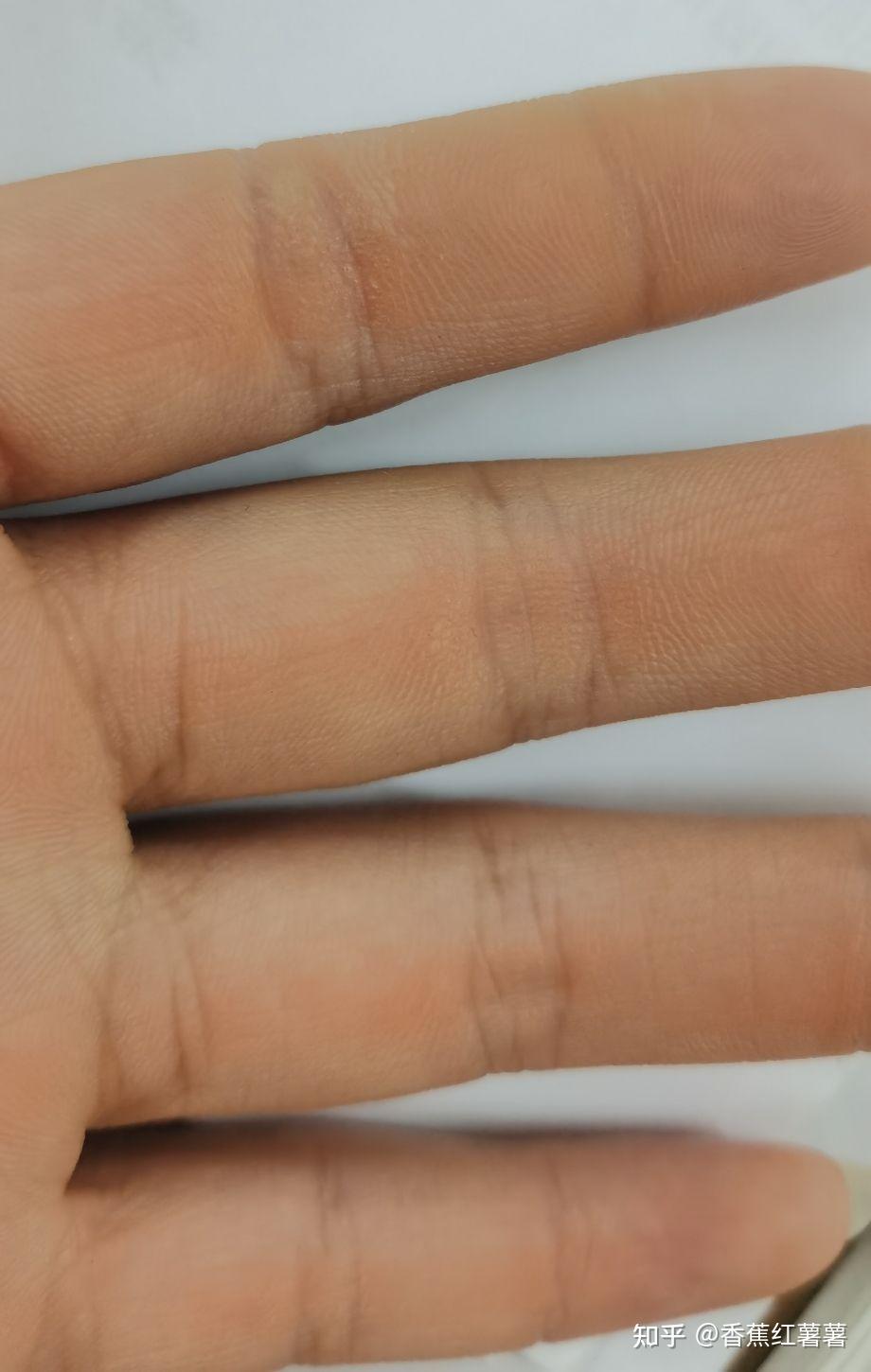 女生怎样改善手掌粗糙问题? - 知乎