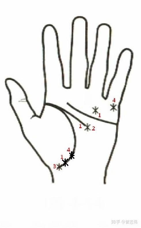 中医手诊学基础手诊的病理纹