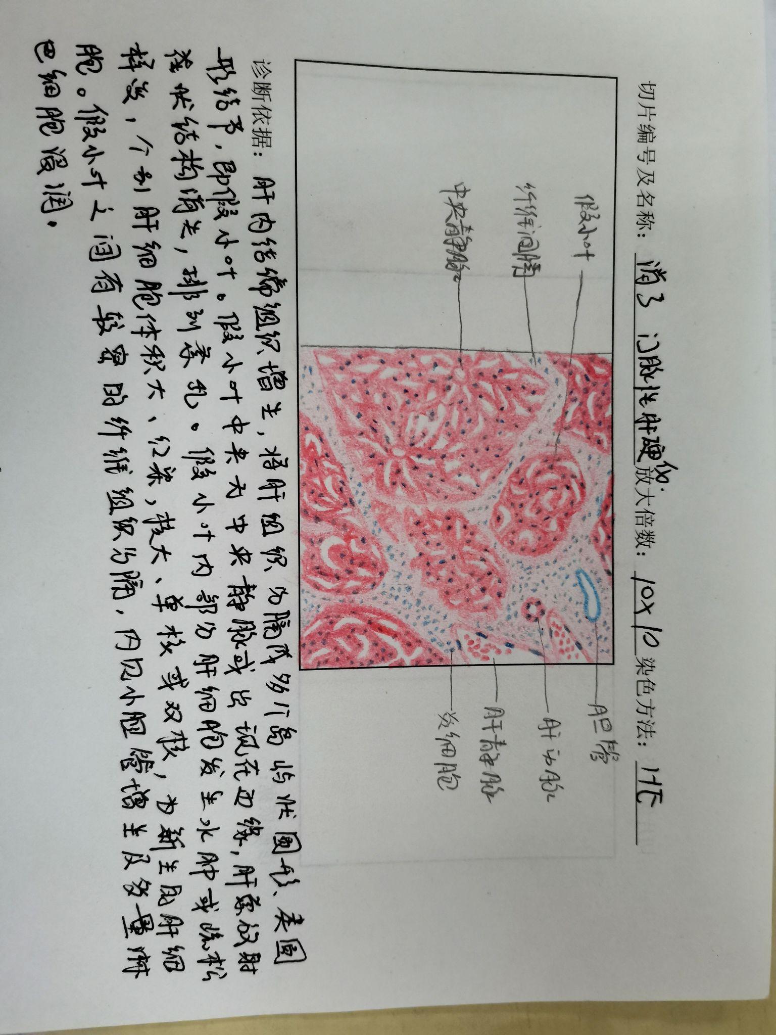 胃溃疡实验报告手绘图图片