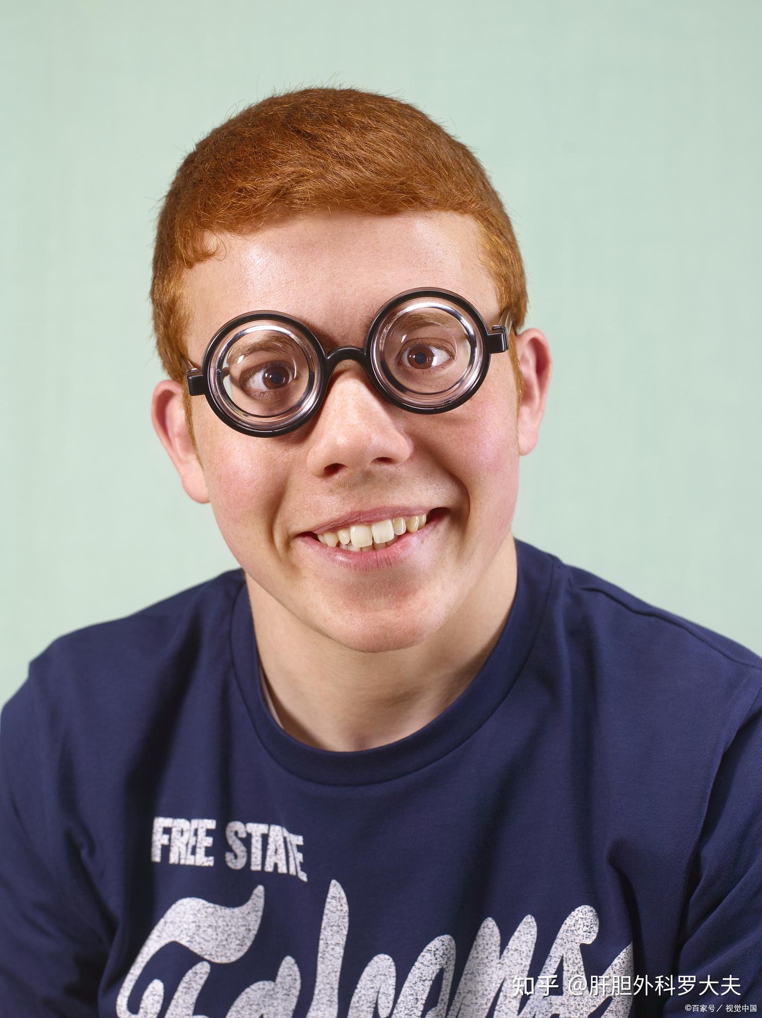 儿童眼健康的八大误区家长们要警惕