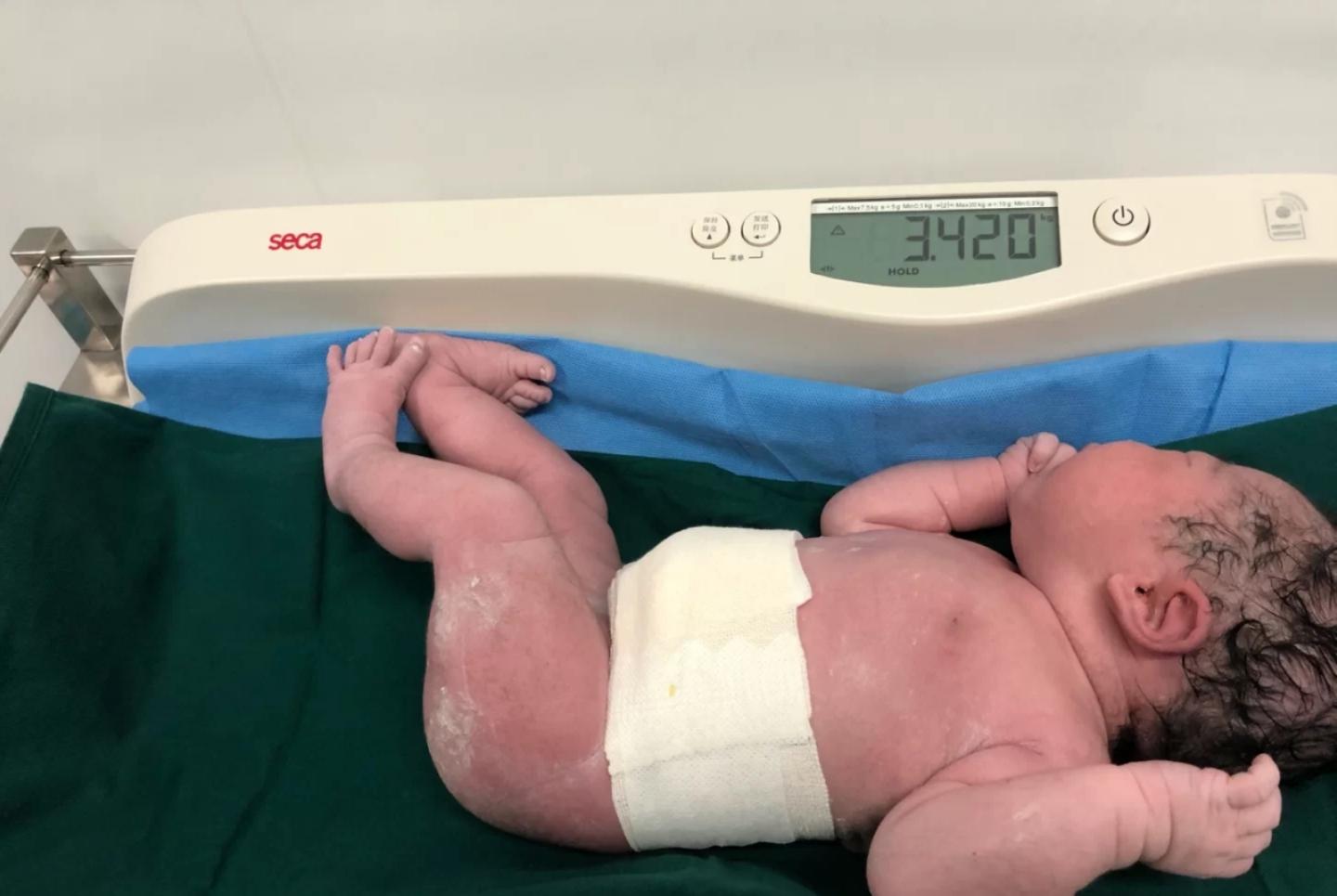 剖腹产为什么安排在38周 而不是足月40周 想剖的宝妈要了解 知乎 剖腹产为什么安排在38周 而不是足月40周 想剖的宝妈要了解 知乎