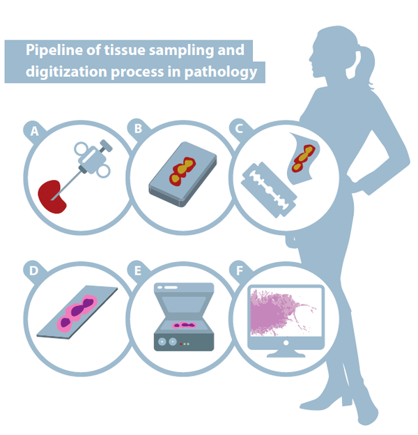 J Intern Med.基于AI和ML的计算病理学的最新进展 知乎
