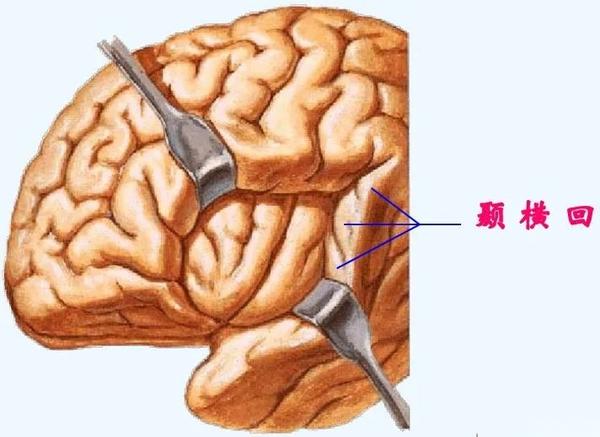 【推荐】颞叶 解剖、血供及影像 - 知乎