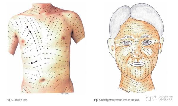 傷跡は消せますか?
