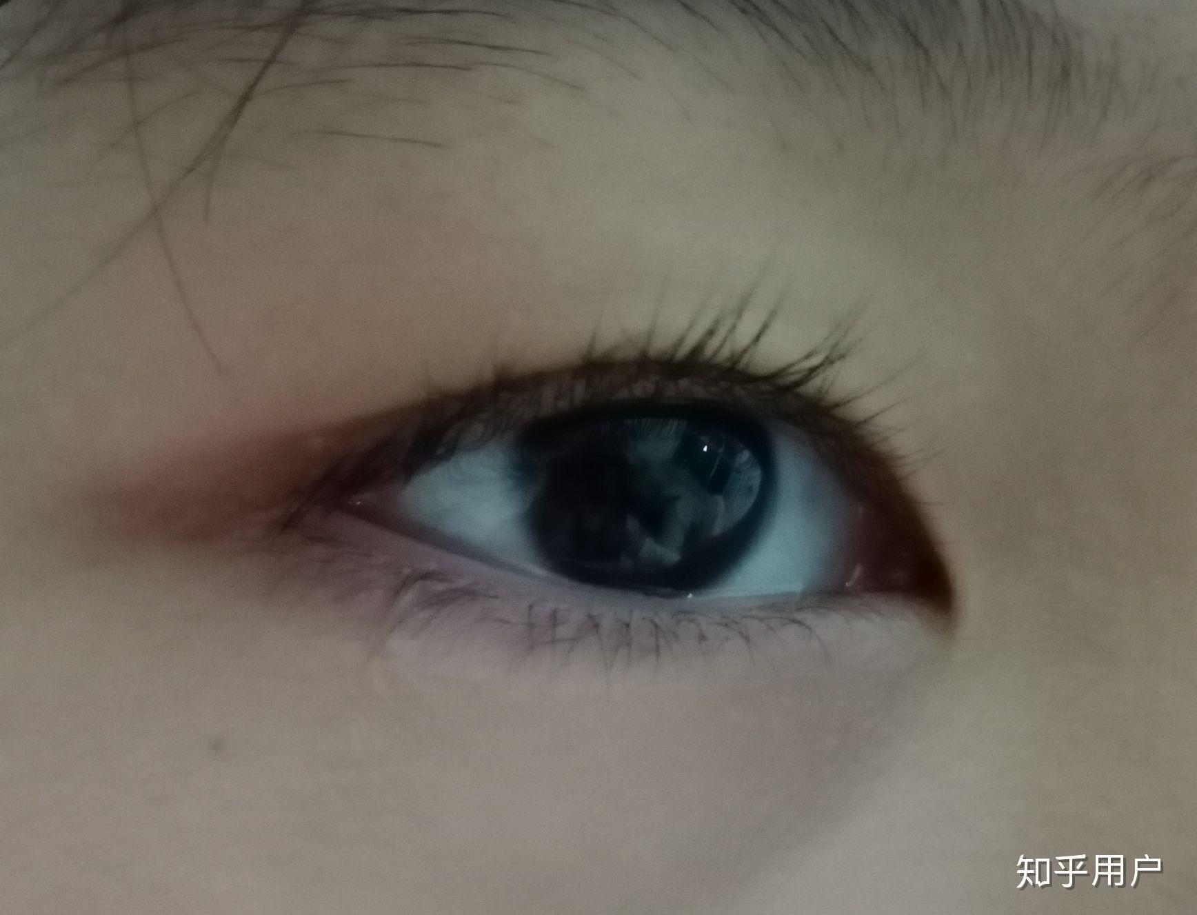 天生眼尾泛红是怎么回事(°д°)? - 知乎