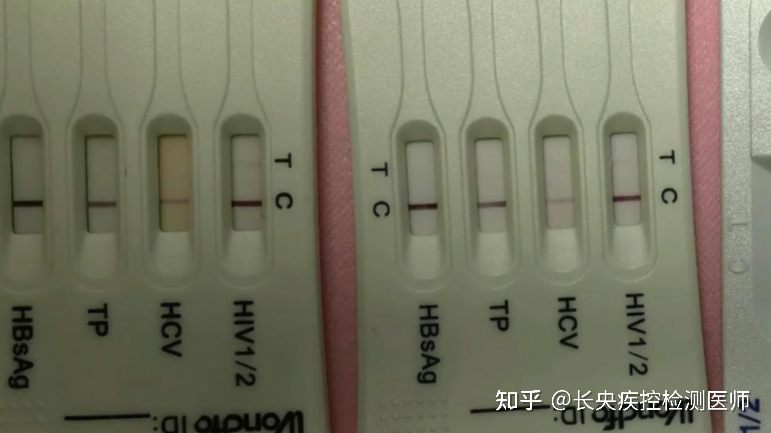 hiv试纸结果怎么看图解图片