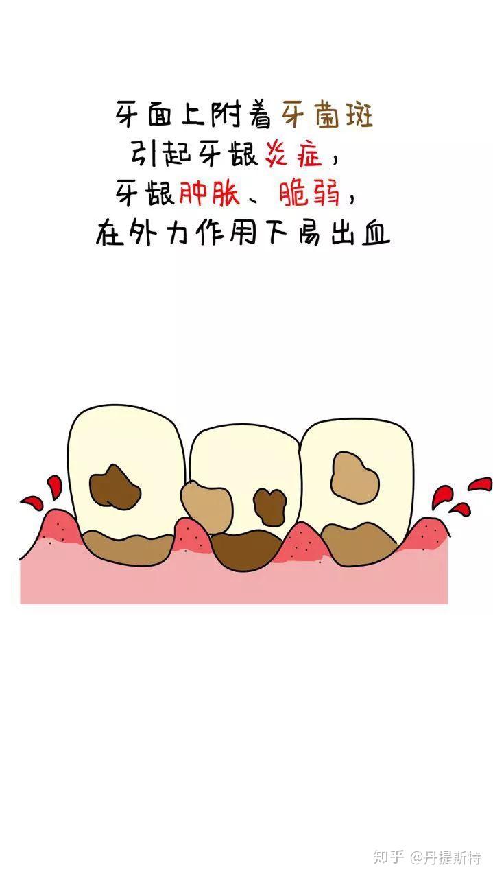 牙龈出血什么原因