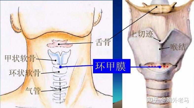 姑娘喉咙疼患急性会厌炎,从就诊到去世仅十分钟,什么是急性会厌炎?哪些因素会诱发该疾病? - 知乎