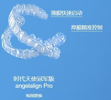 时代天使多少钱?各版本之间的区别,该怎么去挑选? - 知乎
