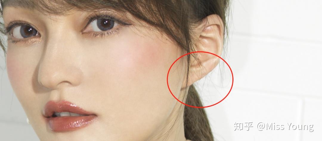 耳朵有褶皱表示有心脏疾病吗? - 知乎