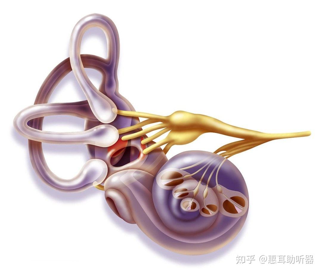 听神经细小系列科普|(三)听神经细小听力学干预方案 - 知乎