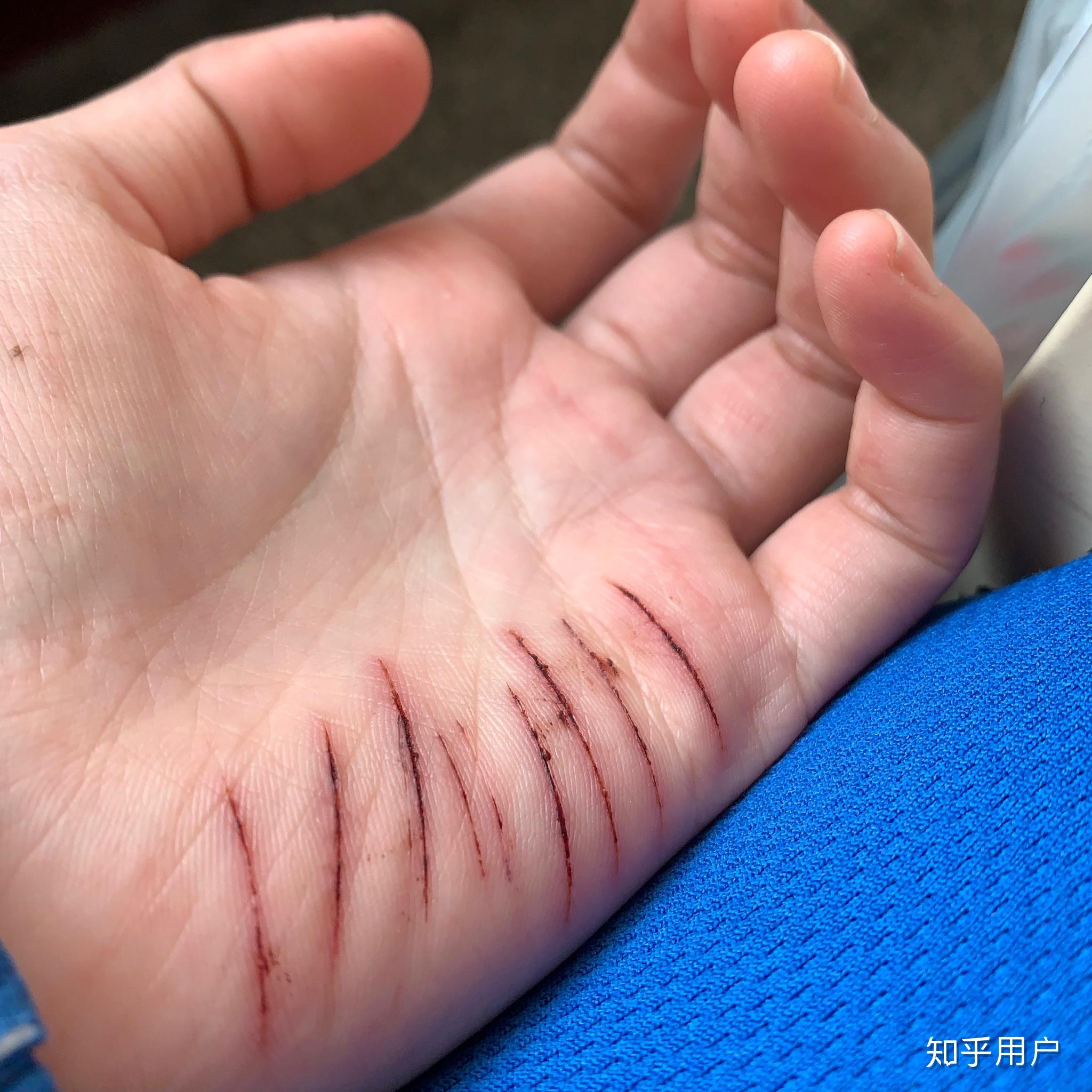 自残属于什么心理