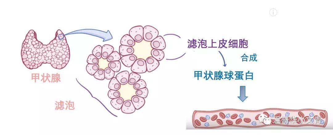 除了正常的甲状腺细胞,乳头状癌/滤泡癌/嗜酸细胞癌也能