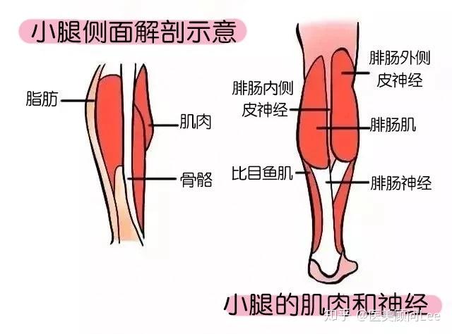 脂肪型腿粗:是指小腿皮脂含量较高的小腿,简单粗暴的说就是脂肪堆积