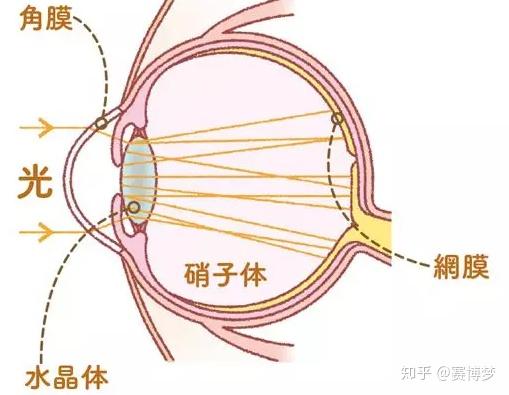 从50岁开始增加 在60岁左右被发现的白内障 知乎