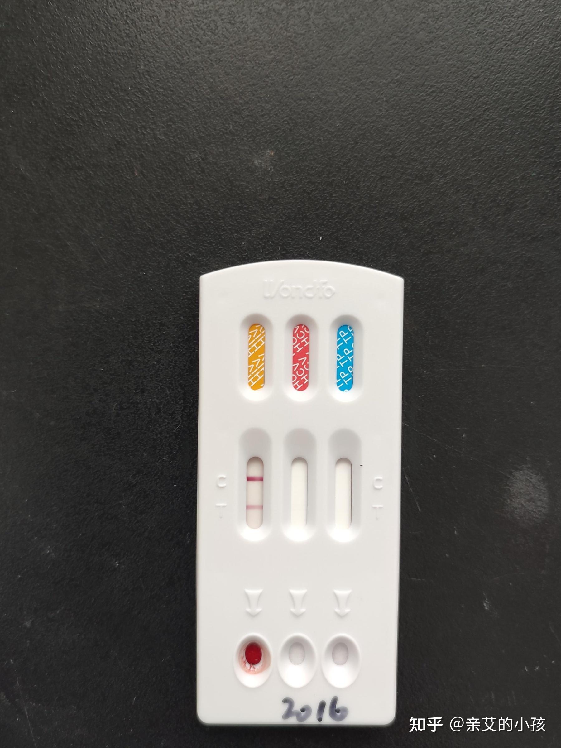 万孚hiv试纸 请大家帮忙看一下 是包埋线还是阴性?