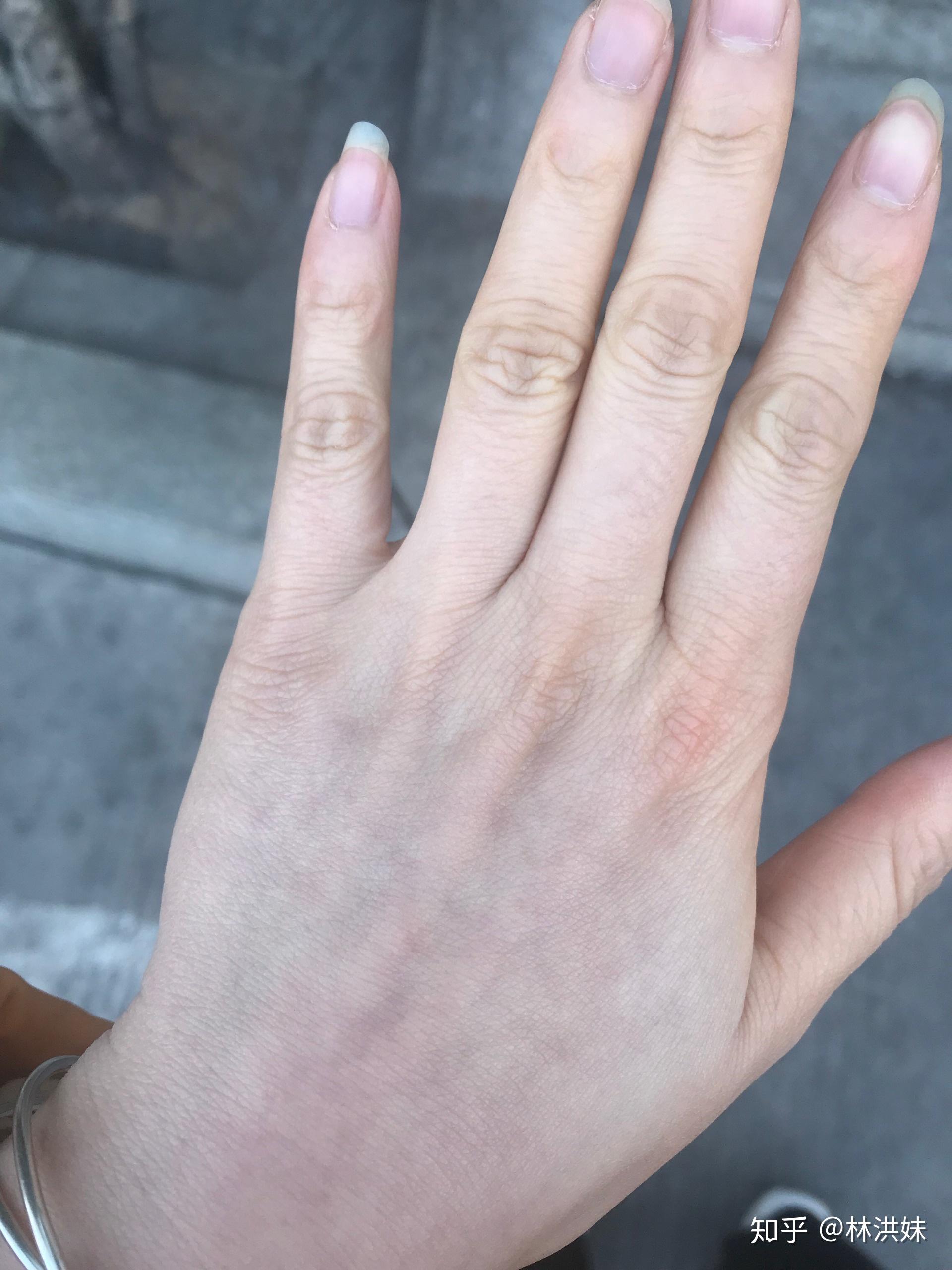 手掌发黄是为什么? - 知乎