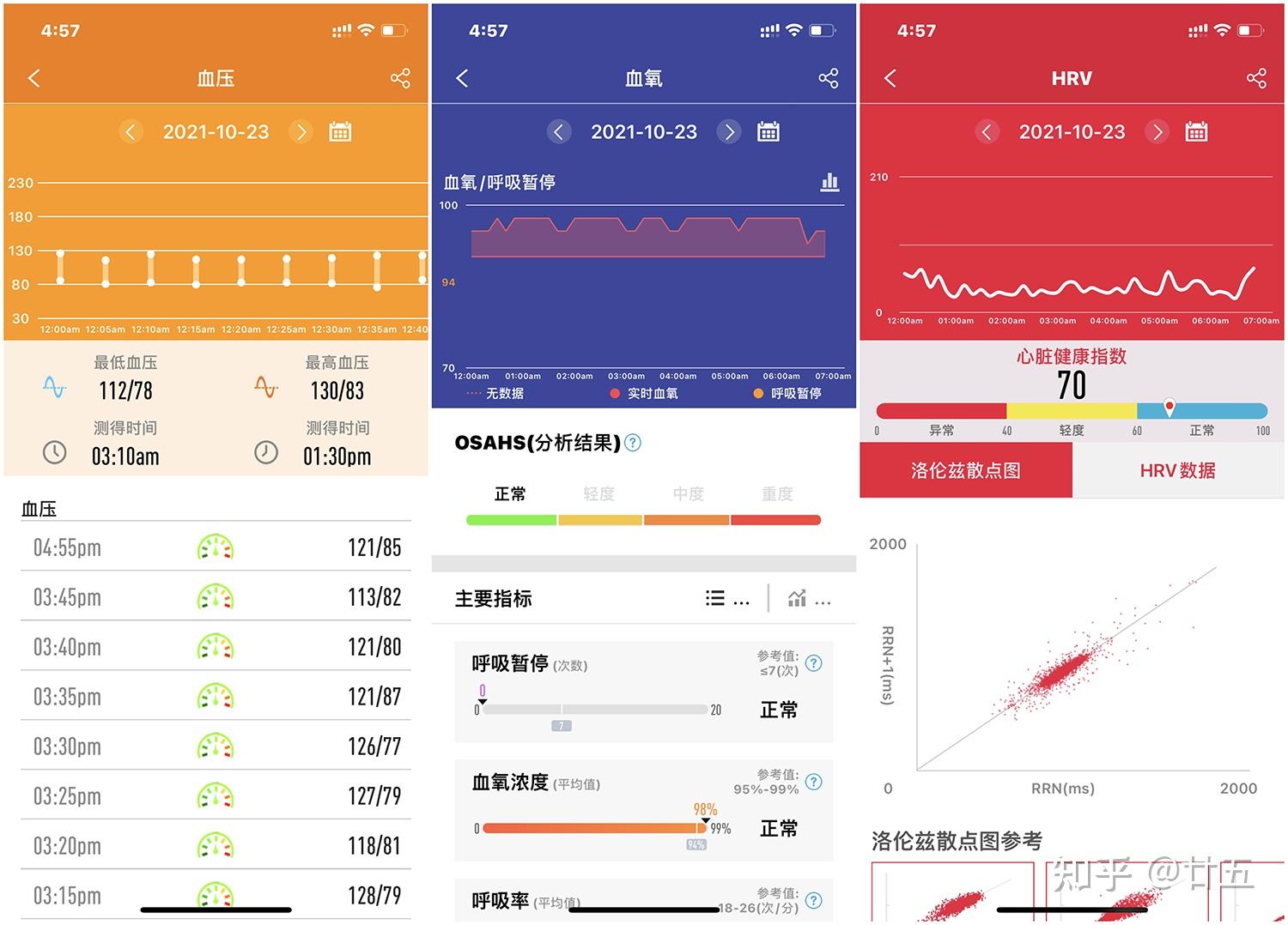 血压监测,心电监测,健康睡眠监测以及血氧监测,洛伦兹报告,app心脏