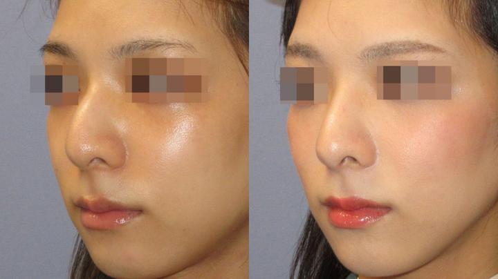 鹰钩鼻子的男人怎么样，鹰钩鼻子的男人怎么样图片