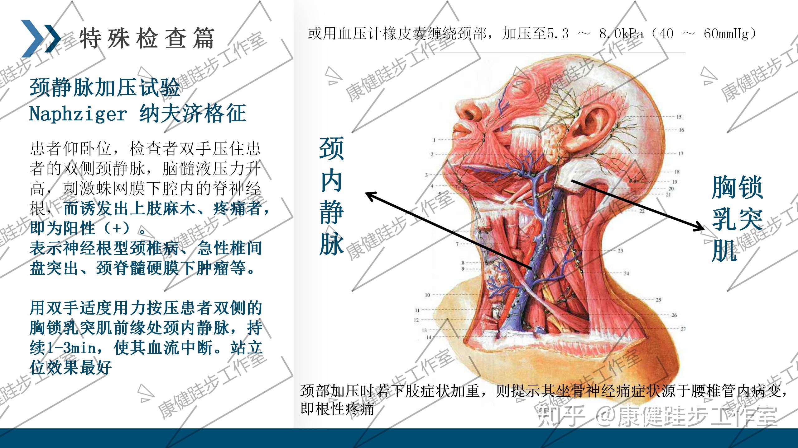v2-e7468ff7cb1b7683bee8e54d5f7d60d8_r.jpg