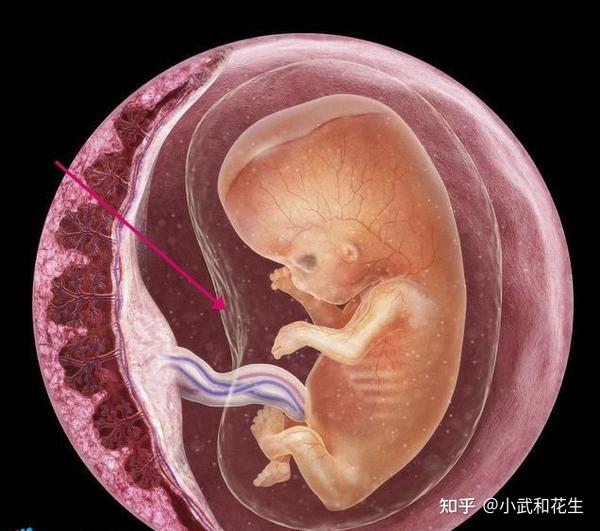胎膜完整图片图片