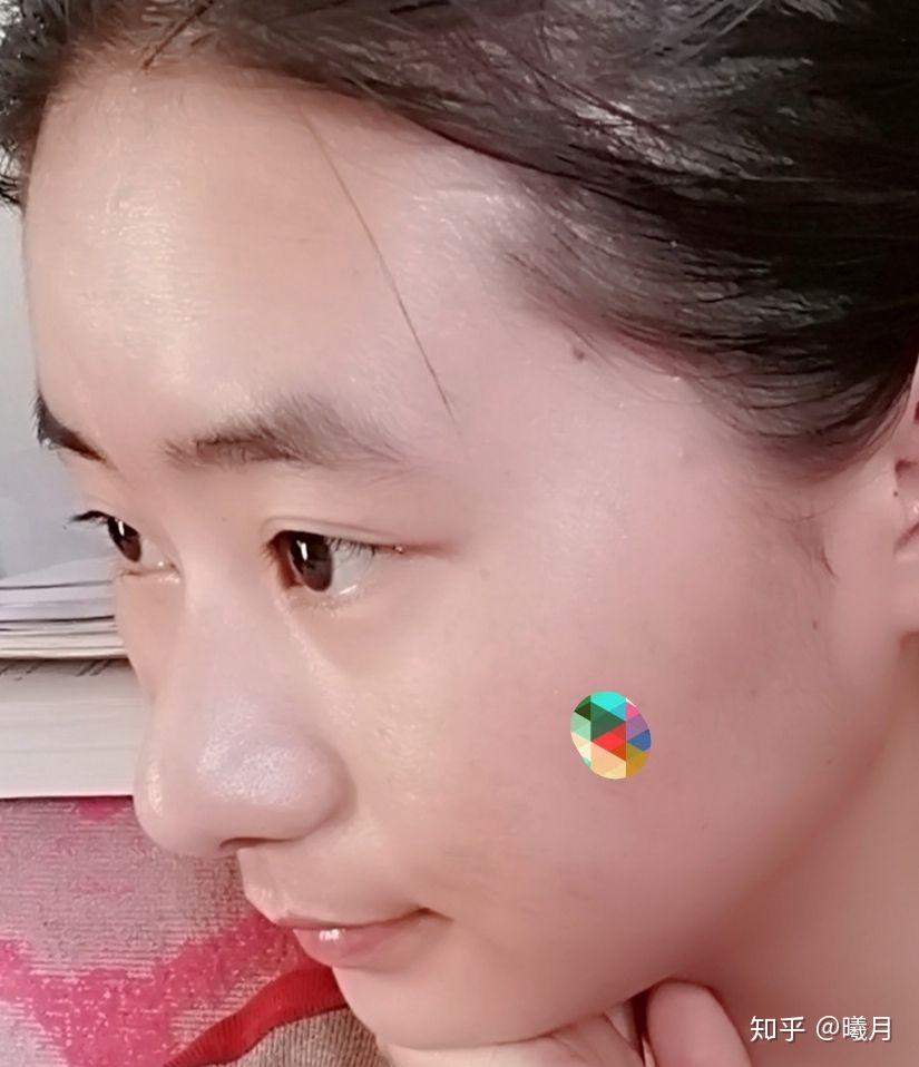 大鼻子怎么办我还是个女孩子啊