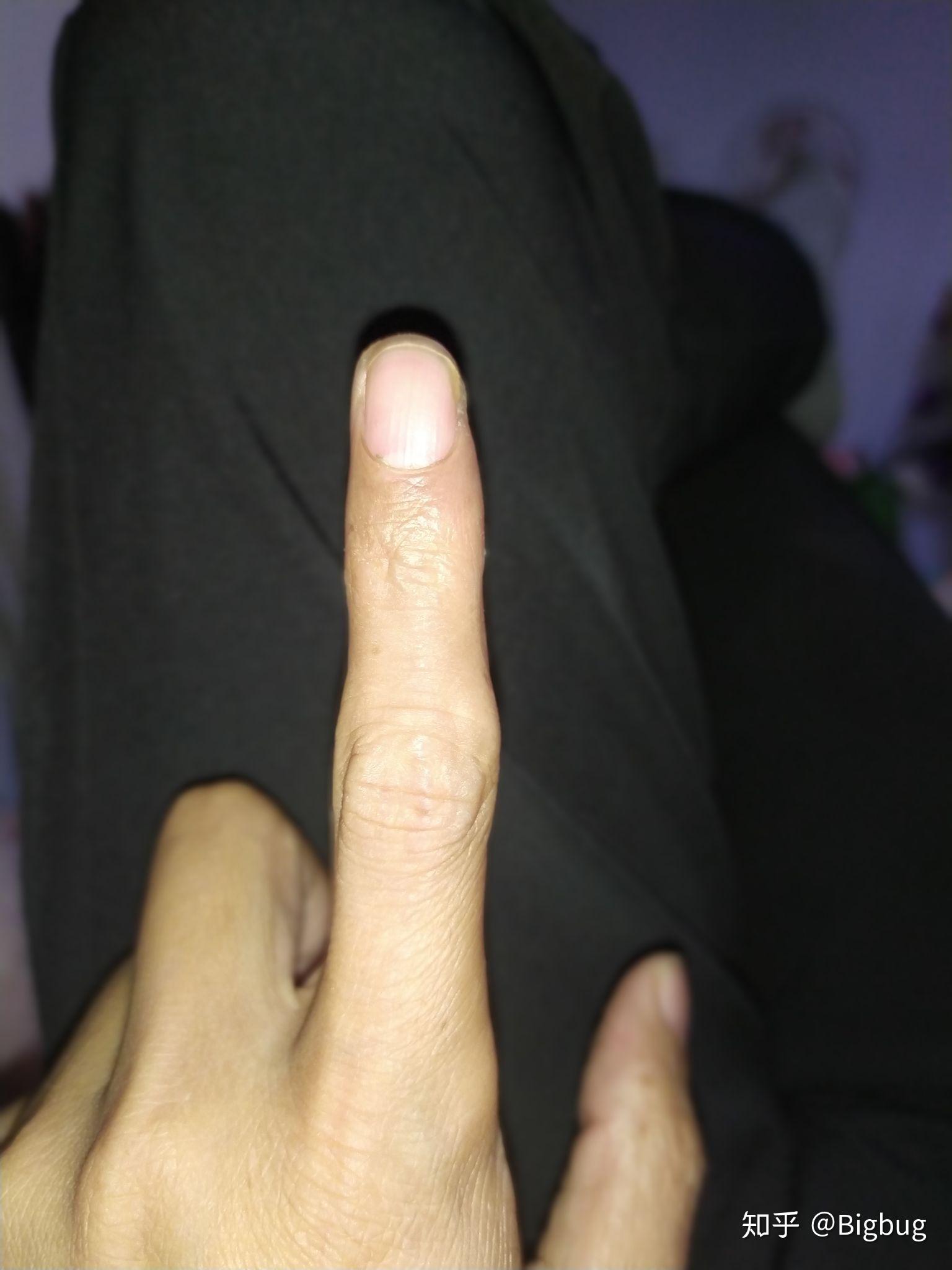 我的左手食指关节大,第二指节中间凹,肉少,大横按总有一个弦在第二指