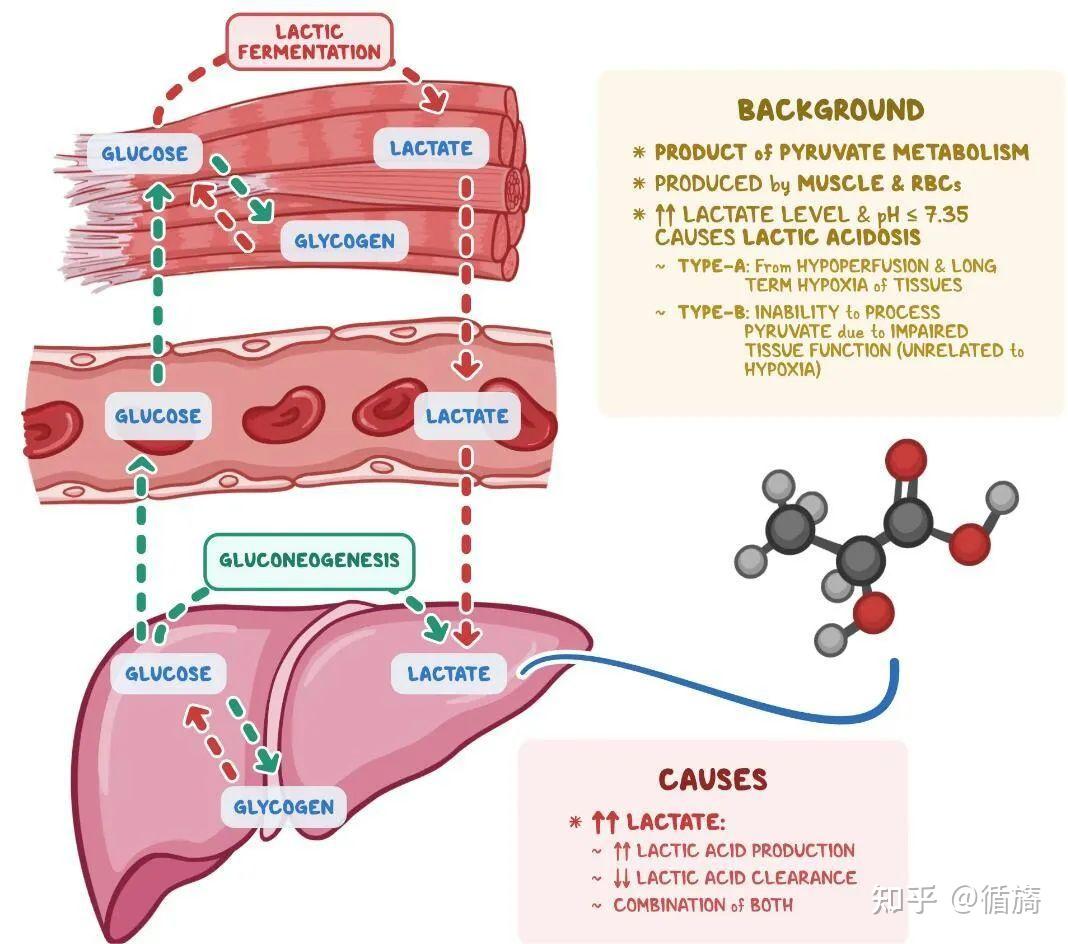 乳酸性酸中毒常见的症状有哪些？ 知乎