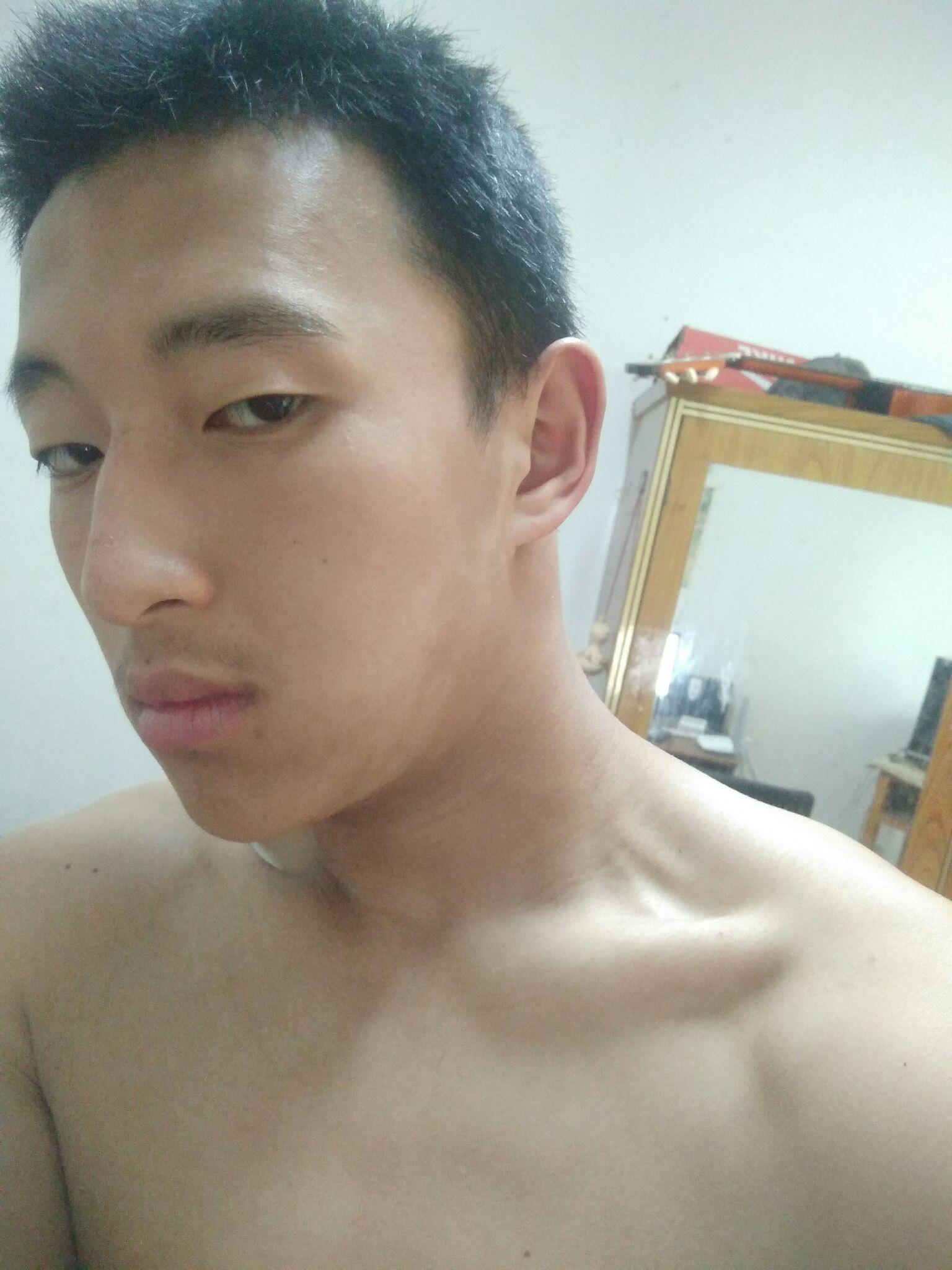 脸两边很黑好长时间了