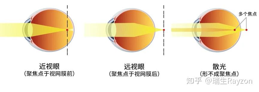离焦量是什么? - 知乎