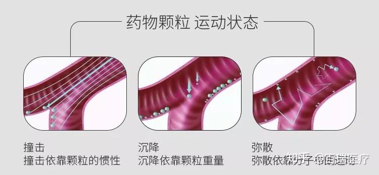 雾化有什么作用?哪些情况需要雾化治疗? - 知乎