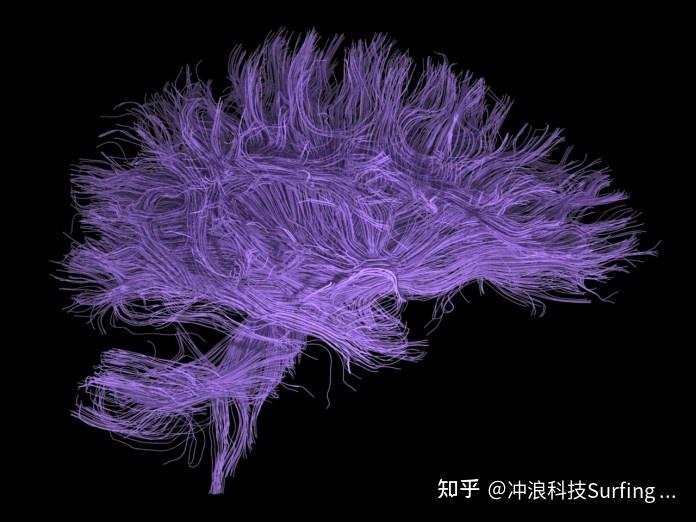 bp人工神经网络模型 matlab代码_人工神经网络的工作原理_神经网络是人工智能